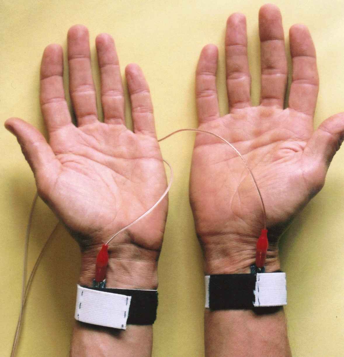 picture of electrodes attached to wrists