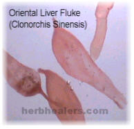 Chinese or Oriental Liver Fluke