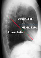 Lung, Anatomy